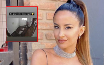 ¡Estremecedor video! Lourdes Sánchez se cayó por las escaleras tras una pelea con el Chato Prada: “Me duelen la muñeca, la cadera y el tobillo”