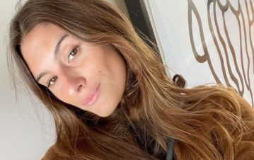 Lola Latorre reveló a qué se deben las marcas en el cuerpo que aparecieron en Miami que preocuparon a su familia