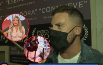 La sorpresiva respuesta de Fede Bal cuando le preguntaron si se borraría el tatuaje de la boca de Laurita Fernández