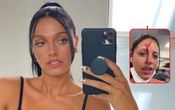 ¡Preocupación! El fuerte y sangriento golpe que sufrió Oriana Sabatini mientras entrenaba
