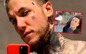 ¡Es otro! Alex Caniggia se operó la mandíbula y mostró su impactante cambio físico: “Te re cabió...”