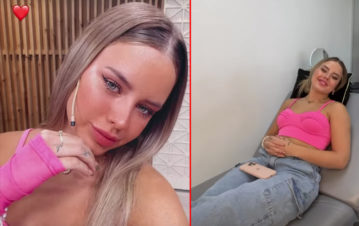 Coti de Gran Hermano se hizo otro retoque estético en el rostro: “Es lo mejor del mundo para…”