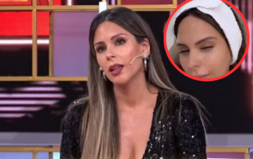 Barby Franco mostró un video del tratamiento estético que se hizo tras ser mamá de Sarah