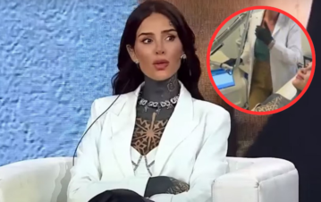 El impresionante tratamiento para borrarse los tatuajes al que se sometió Cande Tinelli