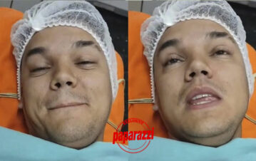 Brian Lanzelotta se hizo una cirugía estética y mostró el antes y después de la operación: "Te sacan la..."