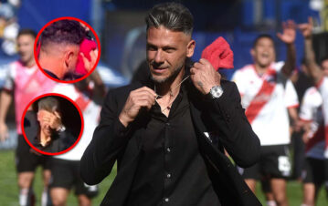 Así quedó el rostro de Martín Demichelis tras ser agredido por hinchas de Boca