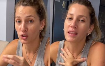 ¿Qué se hizo? Mica Viciconte mostró las impactantes marcas que le dejó un tratamiento: “Mi cuerpo pedía…”