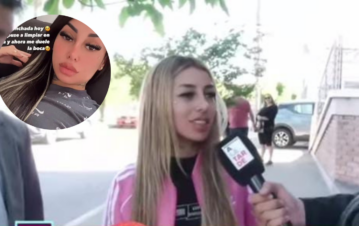 ¡Nooo! Así le quedó la cara a Tamara Báez, la ex de L-Gante, después de hacerse una cirugía