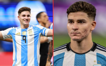 El tratamiento anti granos que hizo Julián Álvarez para cambiar su look