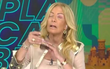 Cómo le quedó la cara a Susana Roccasalvo luego de sufrir una infección en la vista